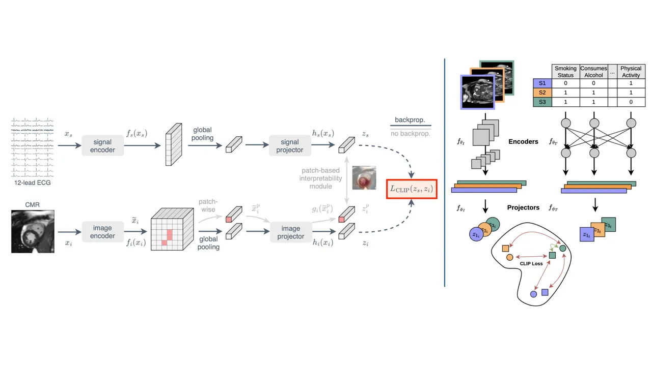 Multi-modal AI leveraging ECG and tabular data alongside cardiac MRI for cardiovascular analysis