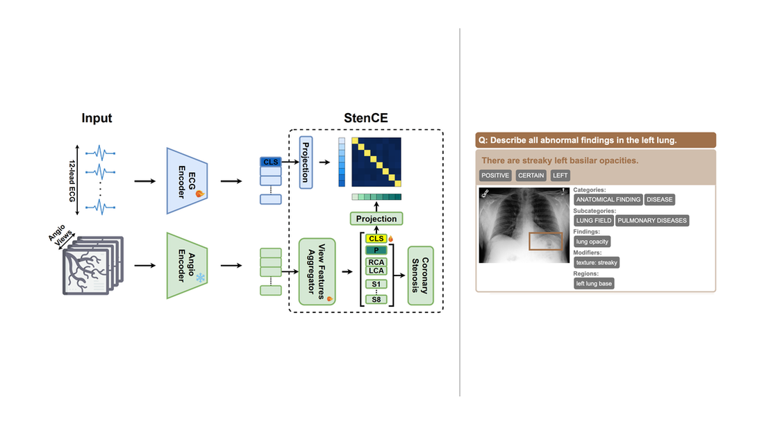 Two panels: multimodal representation learning aligning ECG and cardiac MRI, and grounded vision-language modeling for chest X-ray report generation.